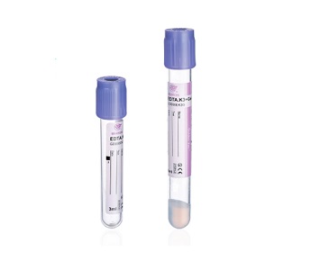 Principle of EDTA Anticoagulant Effect in EDTA Blood Vials